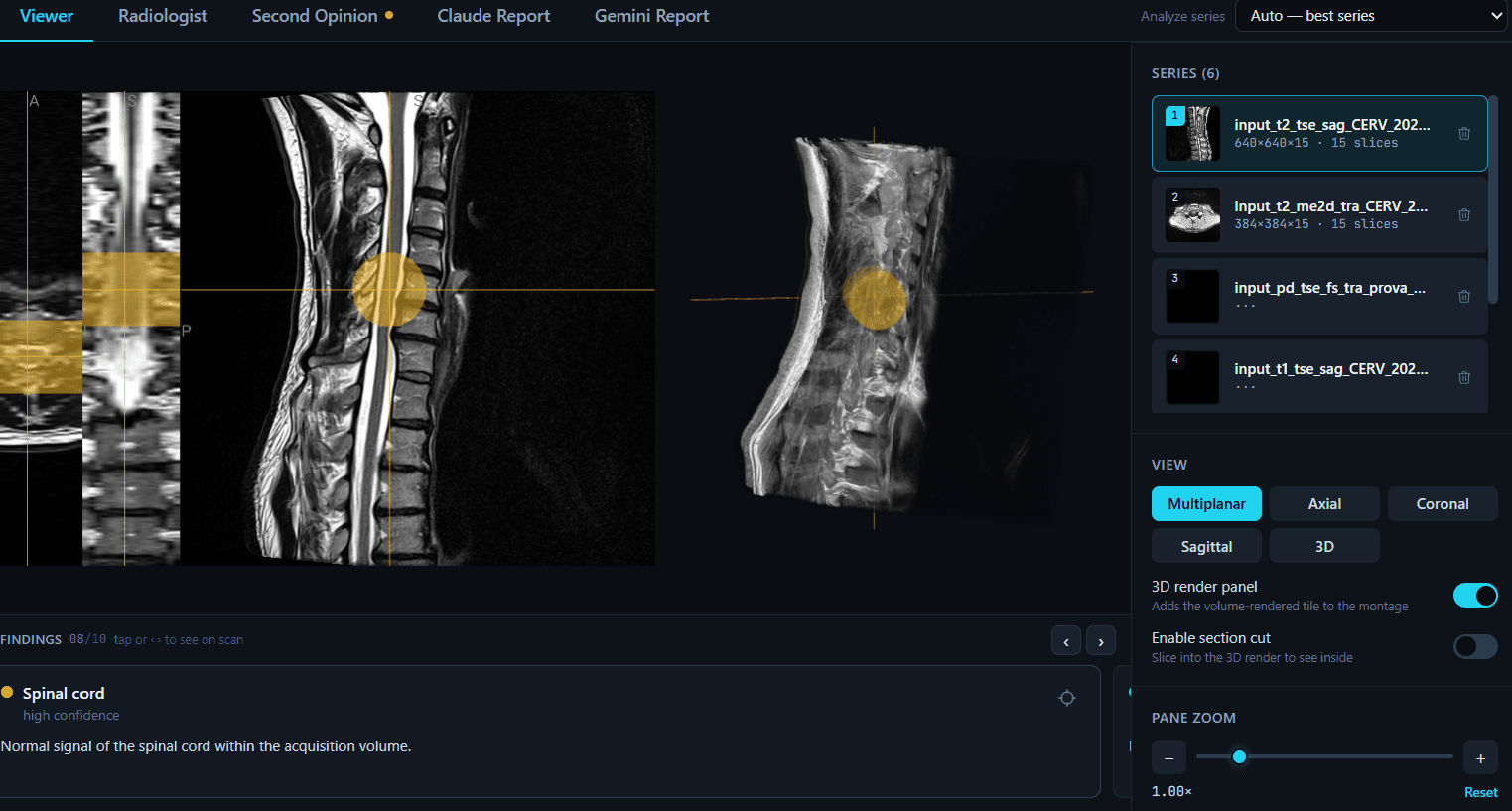 This is what your scan looks like here