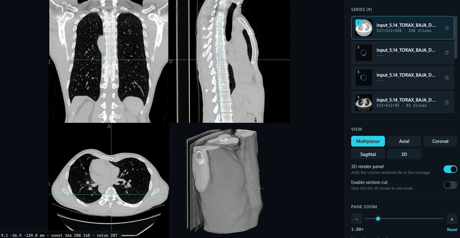 This is what your scan looks like here